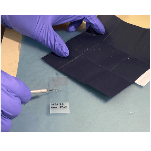 Innovatek MycoPak™ Dermatophyte Specimen Collection Kit