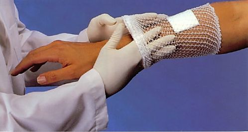 Surgilast Tubular Elastic Dressing Retainer (hand, arm, leg & foot)