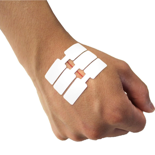 DYNAREX BUTTERFLY FAB ADHESIVE BANDAGE - 3615