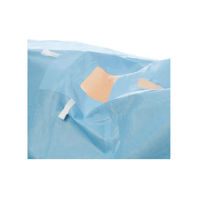 Halyard Laparoscopy/Pelviscopy Drape, with Separate Leggings, W104 x L104, Arm Board 35 - 10 Per Case